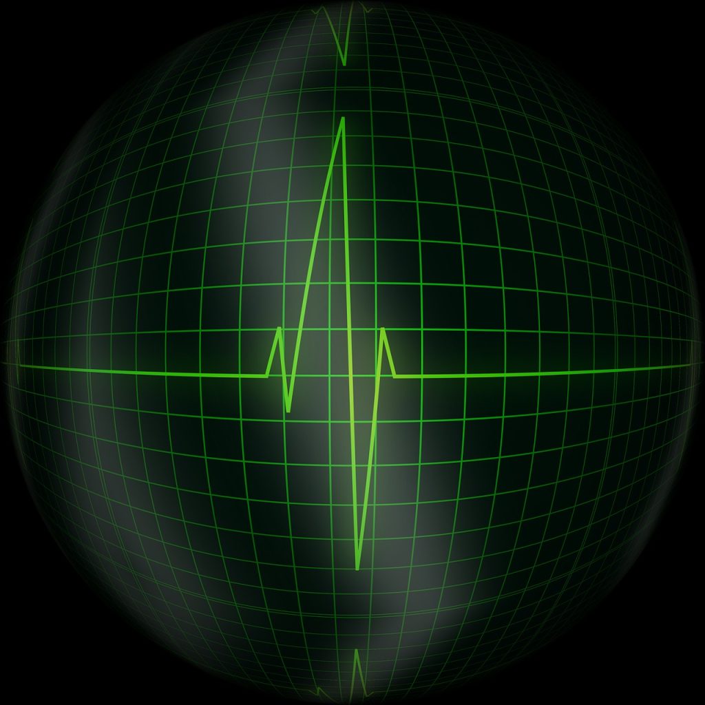 pulse, heartbeat, cardiogram-583782.jpg